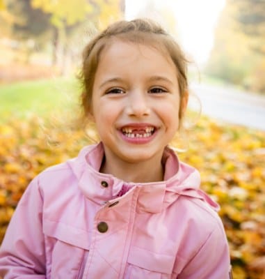 Little girl smiling with missing teeth after baby tooth extraction